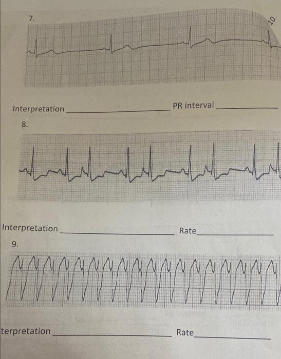13 Rate Interpretation 14 Manbaladora Abandonado Interpretation Rate 15 Dermahadhranfondenbranden Terpretation Rate 3