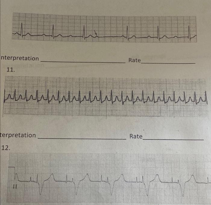 13 Rate Interpretation 14 Manbaladora Abandonado Interpretation Rate 15 Dermahadhranfondenbranden Terpretation Rate 4