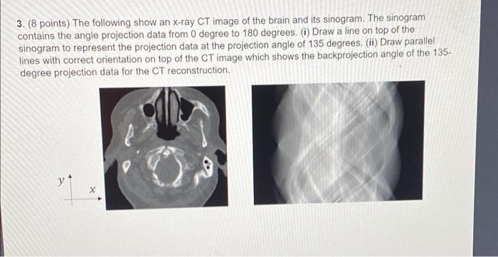 3 8 Points The Following Show An X Ray Ct Image Of The Brain And Its Sinogram The Sinogram Contains The Angle Projec 1