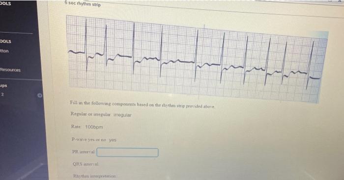 Dols 6 Sec Thythm Strip Dols Tton 2 2 Resources Ps 2 Fill In The Following Components Based On The Shythm Strip Prov 1