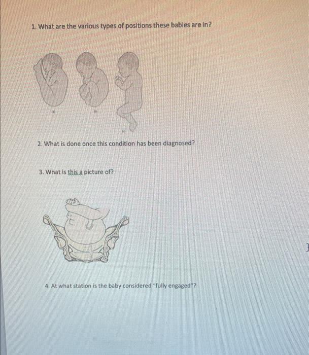1 What Are The Various Types Of Positions These Bables Are In 2 What Is Done Once This Condition Has Been Diagnosed 1