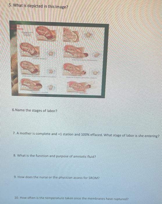 5 What Is Depicted In This Image 6 Name The Stages Of Labor 7 A Mother Is Complete And 1 Station And 100 Effaced 1