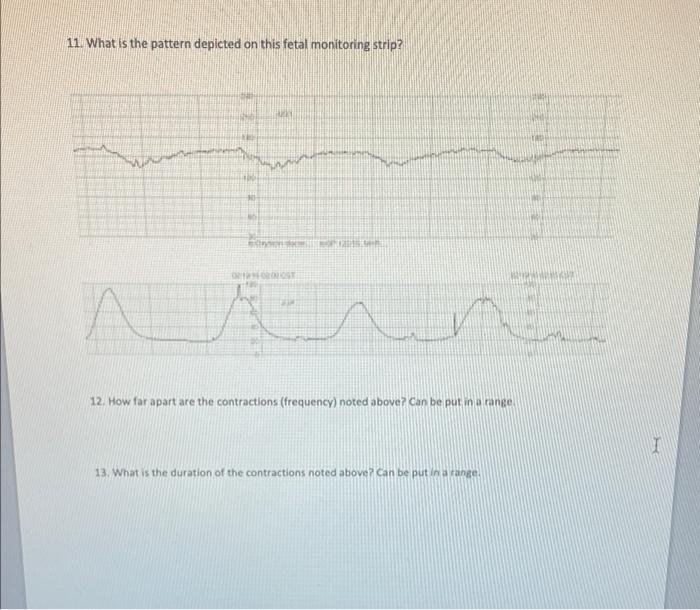 11 What Is The Pattern Depicted On This Fetal Monitoring Strip Www Fen 12 How Far Apart Are The Contractions Freque 1