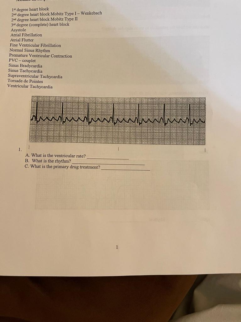 1 Degree Heart Block 2nd Degree Heart Block Mobitz Type I Wenkebach 2nd Degree Heart Block Mobitz Type Ii 3rd Degree 1