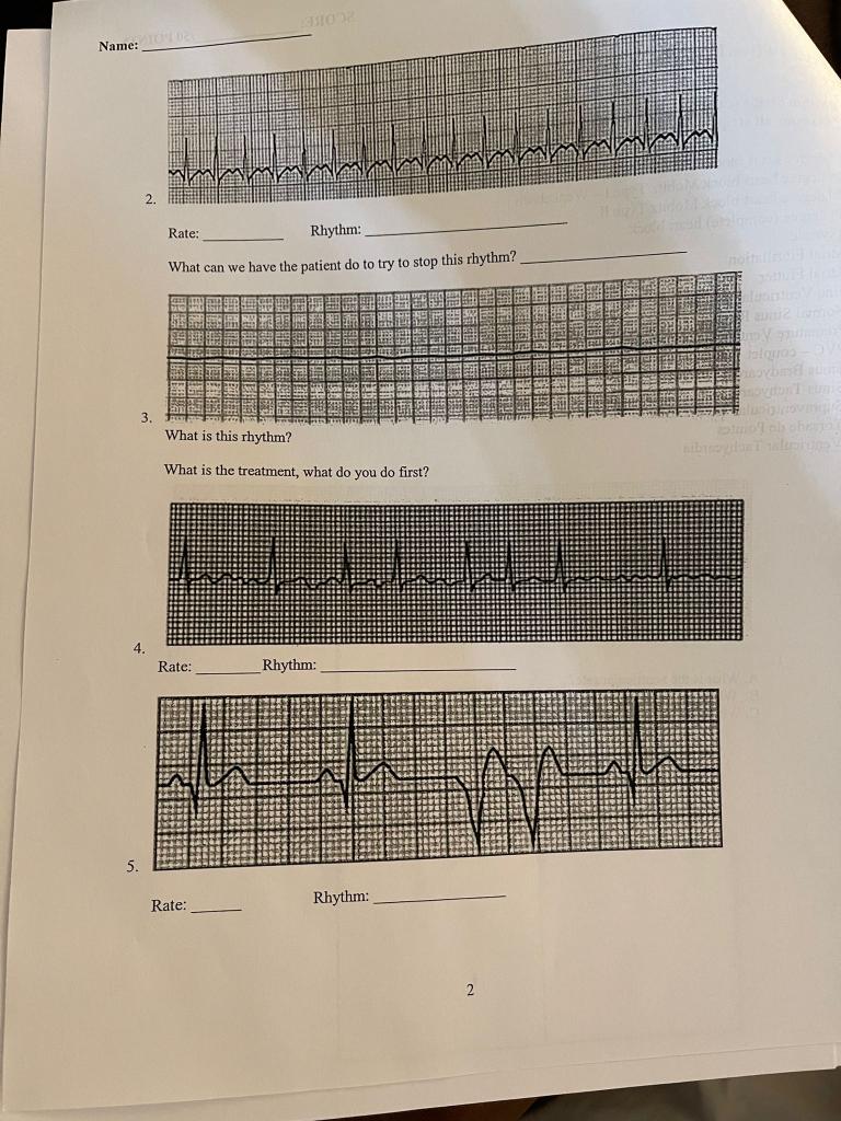 Name Rate Rhythm What Can We Have The Patient Do To Try To Stop This Rhythm 2 Berber He Dee Altro 3 Fo Mah What Is 1