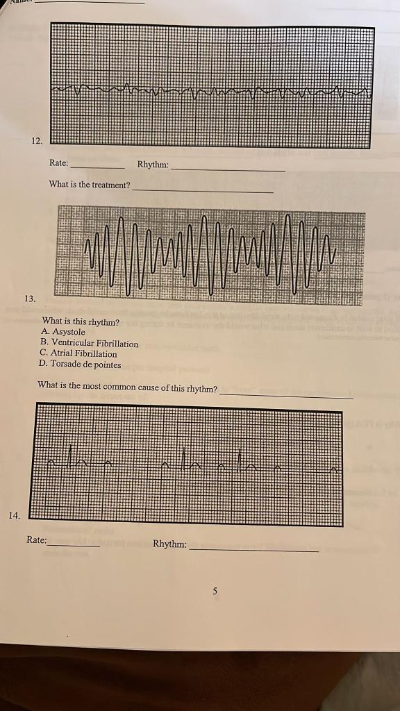 12 Rate Rhythm What Is The Treatment 13 What Is This Rhythm A Asystole B Ventricular Fibrillation C Atrial Fibri 1