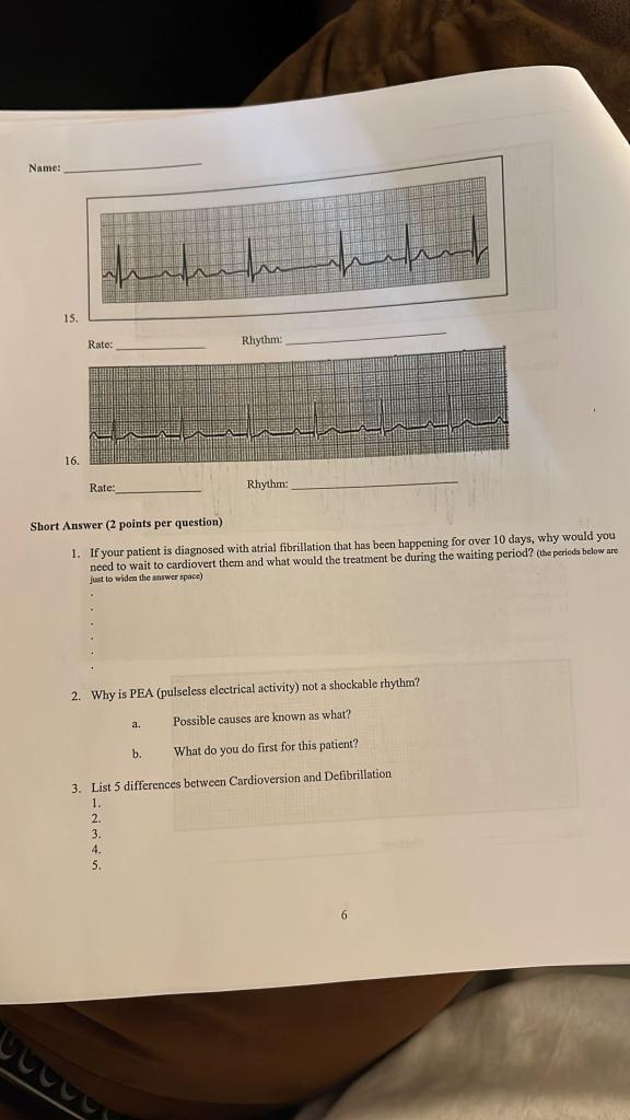 Name Chuh Is Rate Rhythm 16 Rate Rhythm Short Answer 2 Points Per Question 1 If Your Patient Is Diagnosed With 1