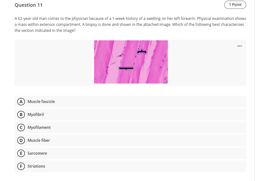 Question 11 A 62 Year Old Man Comes To The Physician Because Of A 1 Week History Of A Swelling On Her Left Forearm Phys 1
