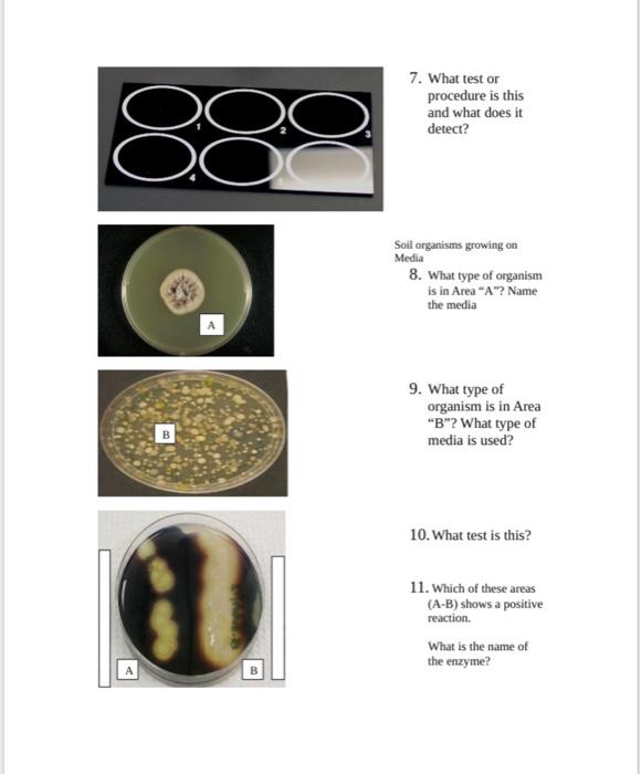 Microbiology Lab Uninoculated A Practical Ii Review 1 What Organism Is This Genus General 2 How Do You Diagnose This 3