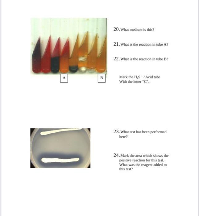 Microbiology Lab Uninoculated A Practical Ii Review 1 What Organism Is This Genus General 2 How Do You Diagnose This 4