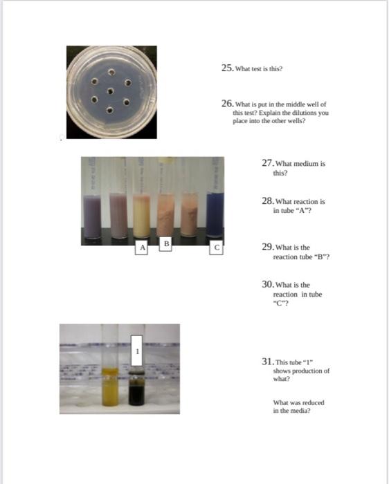 Microbiology Lab Uninoculated A Practical Ii Review 1 What Organism Is This Genus General 2 How Do You Diagnose This 5