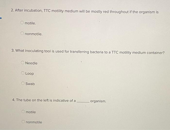 2 After Incubation Ttc Motility Medium Will Be Mostly Red Throughout If The Organism Is Omotile Ononmotile 3 What I 1