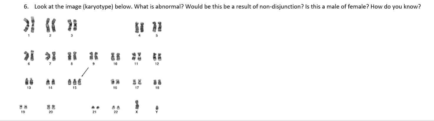 6 Look At The Image Karyotype Below What Is Abnormal Would Be This Be A Result Of Non Disjunction Is This A Male O 1