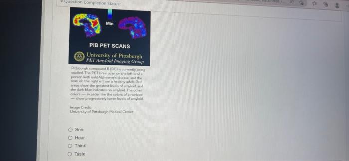 Question Completion Status Question 20 Questions 13 15 Pertain To This Experiment Alzheimer S Disease Ad Is A Devast 2