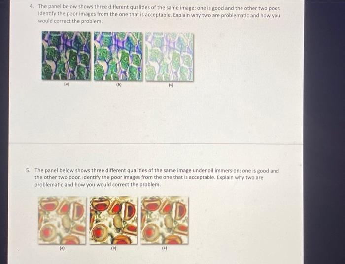4 The Panel Below Shows Three Different Qualities Of The Same Image One Is Good And The Other Two Poor Identify The P 1