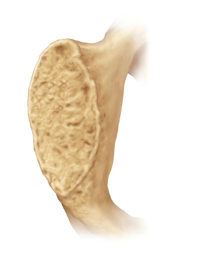 Exercise 3 Aging Examine The Skeletal Material Which Is From A Female And Shows The Symphyseal Face Of The Pubis Compar 1