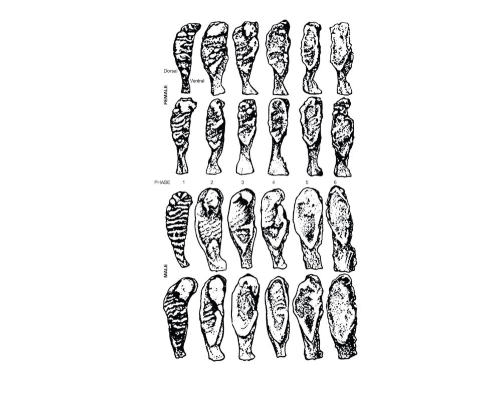 Exercise 3 Aging Examine The Skeletal Material Which Is From A Female And Shows The Symphyseal Face Of The Pubis Compar 2