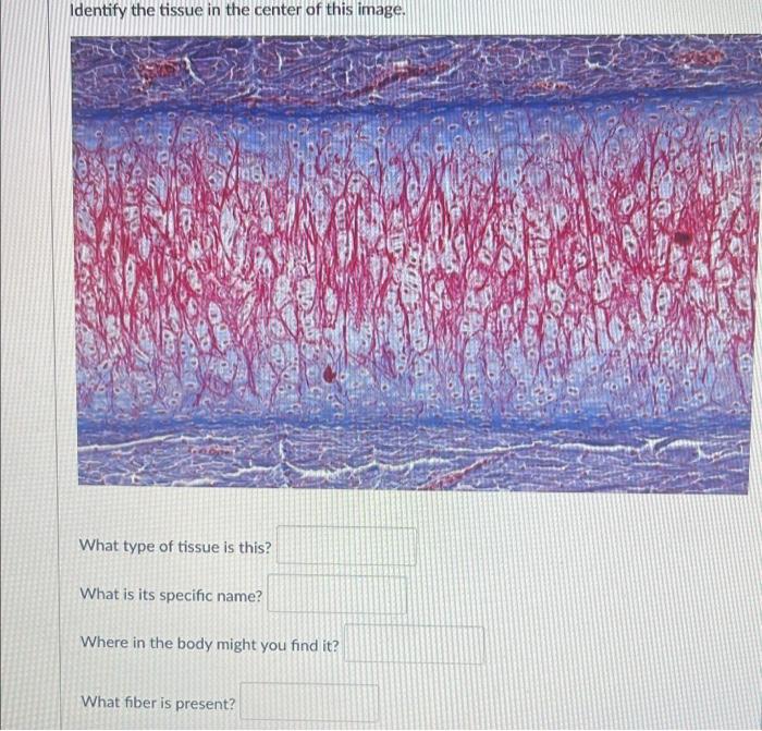 Identify The Tissue In The Center Of This Image What Type Of Tissue Is This What Is Its Specific Name Where In The Bo 1