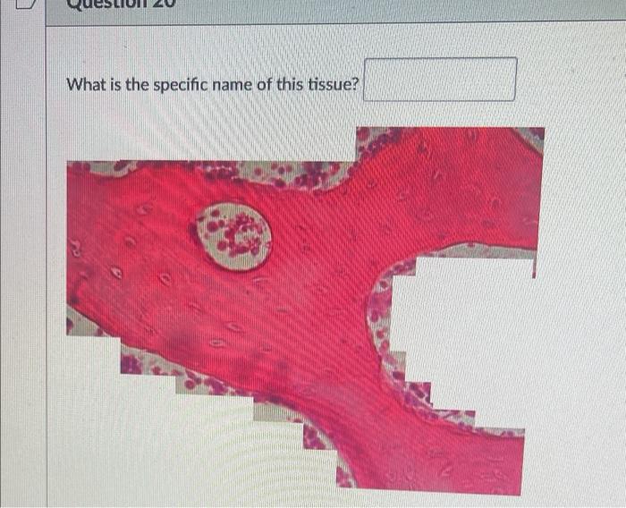 Identify The Tissue In The Center Of This Image What Type Of Tissue Is This What Is Its Specific Name Where In The Bo 2
