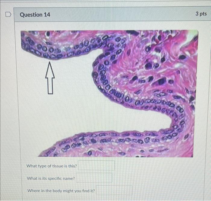 Identify The Tissue In The Center Of This Image What Type Of Tissue Is This What Is Its Specific Name Where In The Bo 3