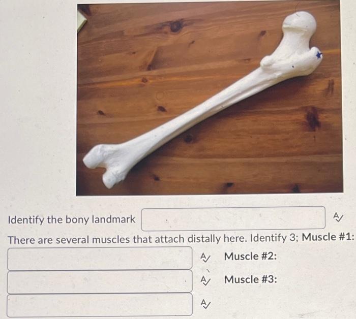 Identify The Bony Landmark A And The A 2 Words Ligament Attaches Here Identify The Bony Landmark A There Are Several 2