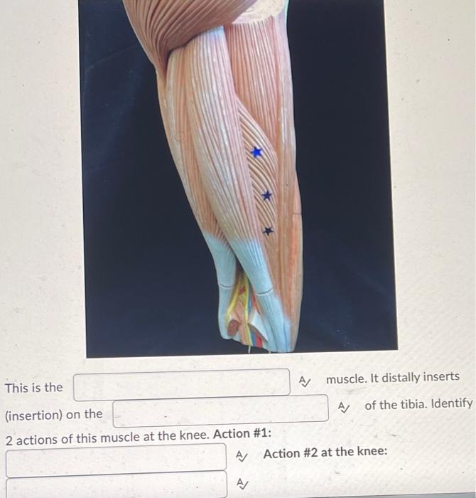 Identify The Bony Landmark A A A 2 Words The And The Muscles Distally Attach Here This Is The Insertion On The 2 2