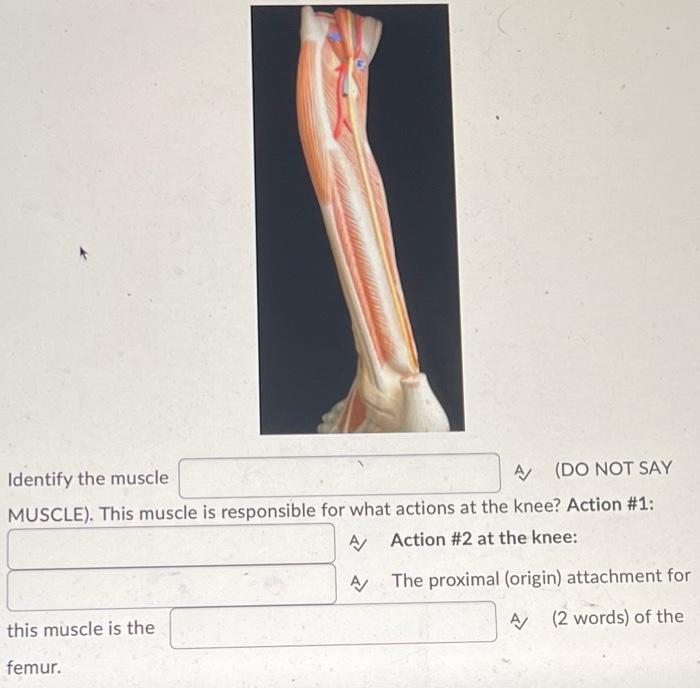 The Red Arrows Are Pointing To The Bony Landmark That Is On The Shaft Of The Humerus A 2 Words This Gives Attachment 2