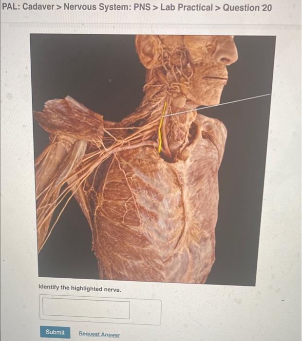 Pal Cadaver Nervous System Pns Lab Practical Question 10 Part A Identify The Highlighted Structure Submit Reque 2