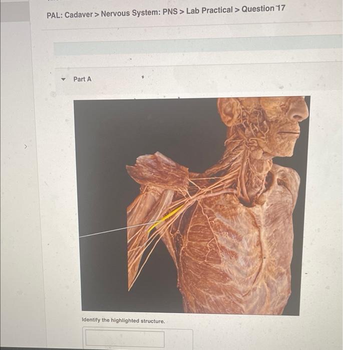 Pal Cadaver Nervous System Pns Lab Practical Question 10 Part A Identify The Highlighted Structure Submit Reque 3