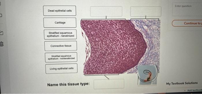 Dead Epithelial Cells Cartilage Stratified Squamous Epithelium Keratinized Connective Tissue Stratified Squamous Epithel 1