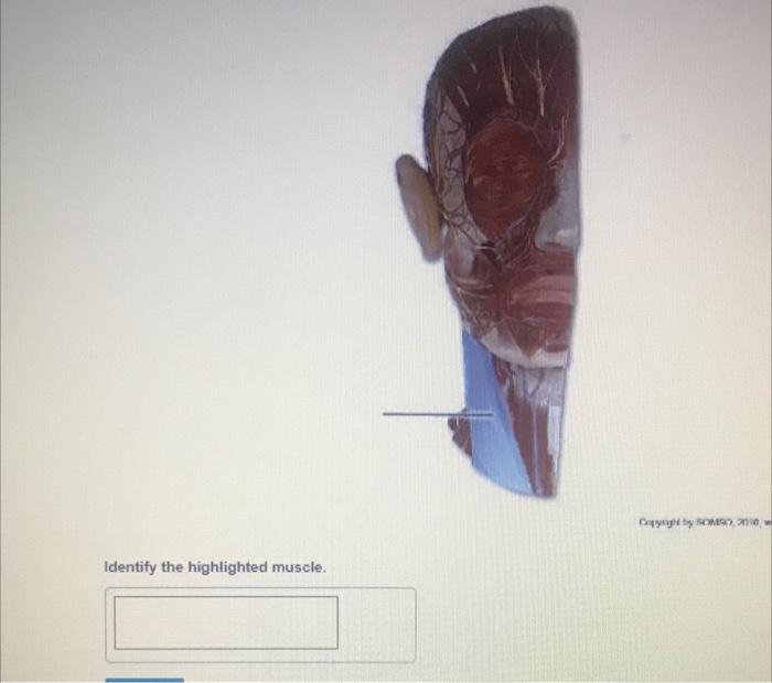 Identify The Highlighted Muscle Copyoght By Sms 1