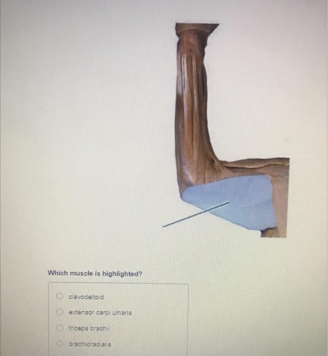 Which Muscle Is Highlighted Oclavodeltoid Extensor Carpi Ulnaris Otriceps Brachii Brachioradialis L 1
