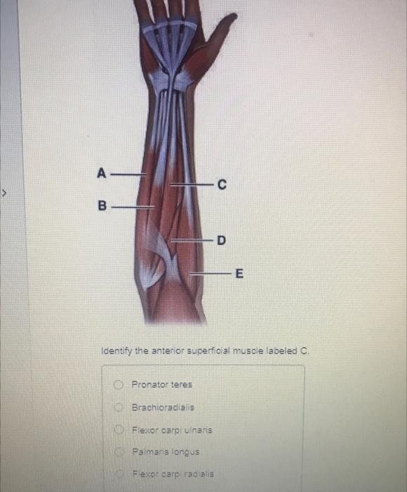 A B Pronator Teres O Brachioradialis C Identify The Anterior Superficial Muscle Labeled C Flexor Carpi Ulnaris Palmaris 1