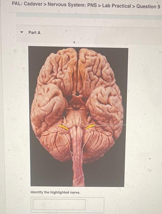 Pal Cadaver Nervous System Pns Lab Practical Question 9 Part A Identify The Highlighted Nerve Pal Cadaver N 1