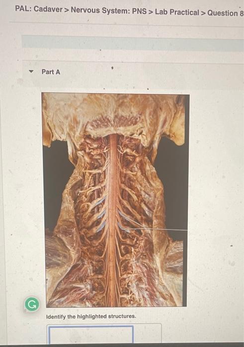 Pal Cadaver Nervous System Pns Lab Practical Question 9 Part A Identify The Highlighted Nerve Pal Cadaver N 2