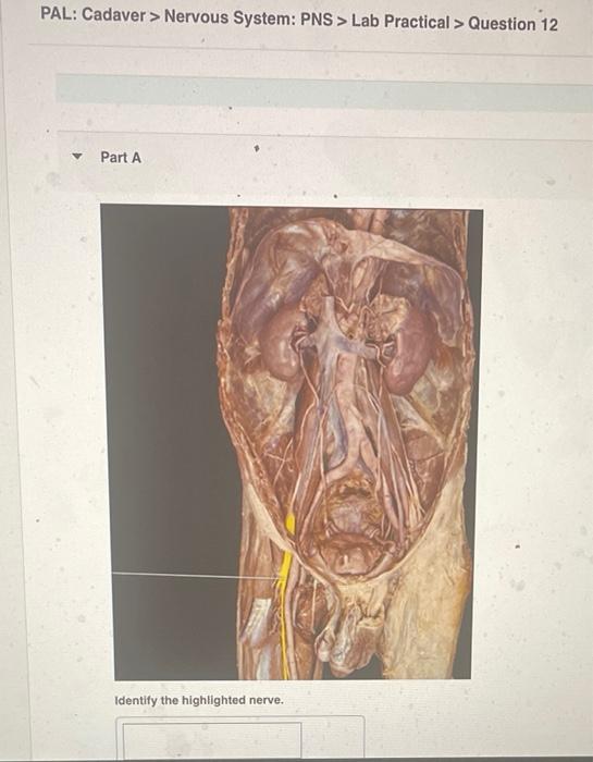 Pal Cadaver Nervous System Pns Lab Practical Question 9 Part A Identify The Highlighted Nerve Pal Cadaver N 3
