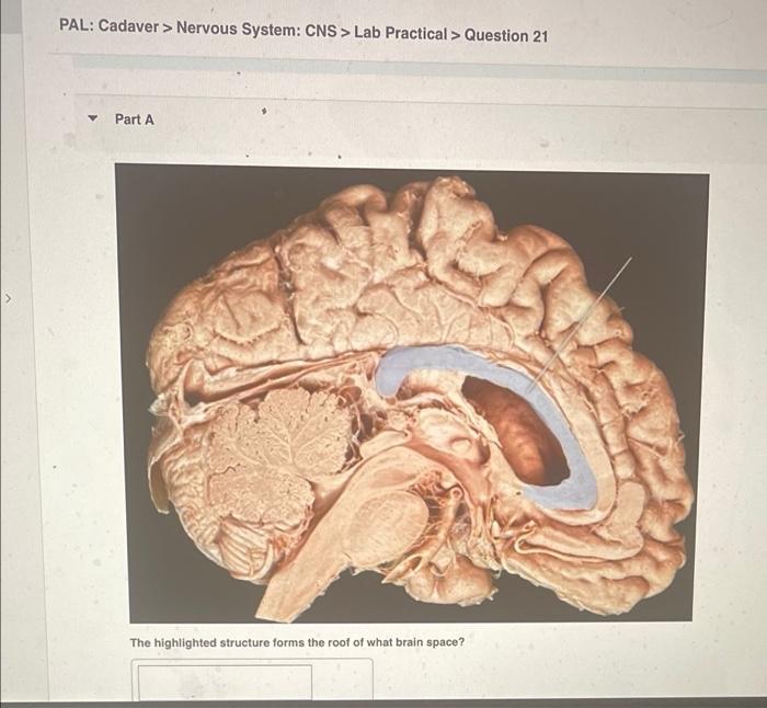 Pal Cadaver Nervous System Pns Lab Practical Question 9 Part A Identify The Highlighted Nerve Pal Cadaver N 4