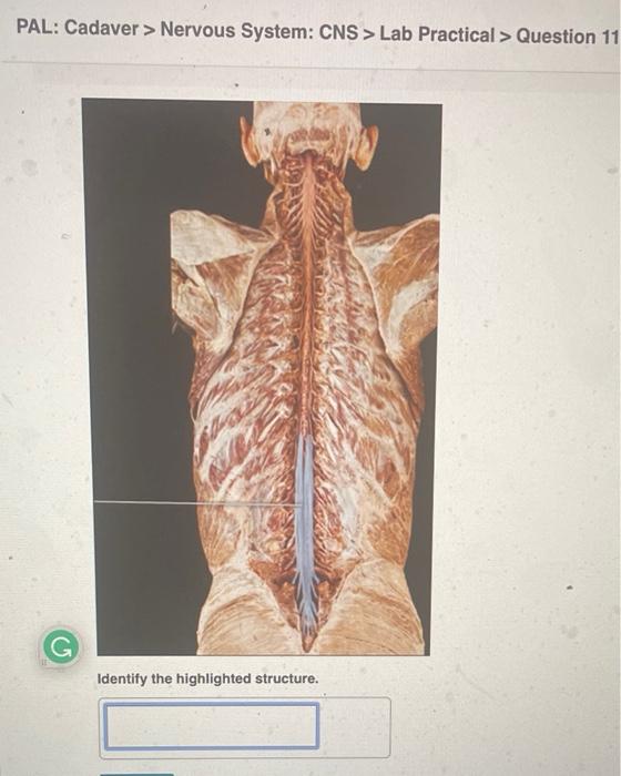 Pal Cadaver Nervous System Cns Lab Practical Question 11 Identify The Highlighted Structure 40 Pal Cadaver N 1