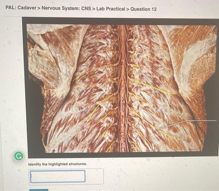 Pal Cadaver Nervous System Cns Lab Practical Question 11 Identify The Highlighted Structure 40 Pal Cadaver N 2