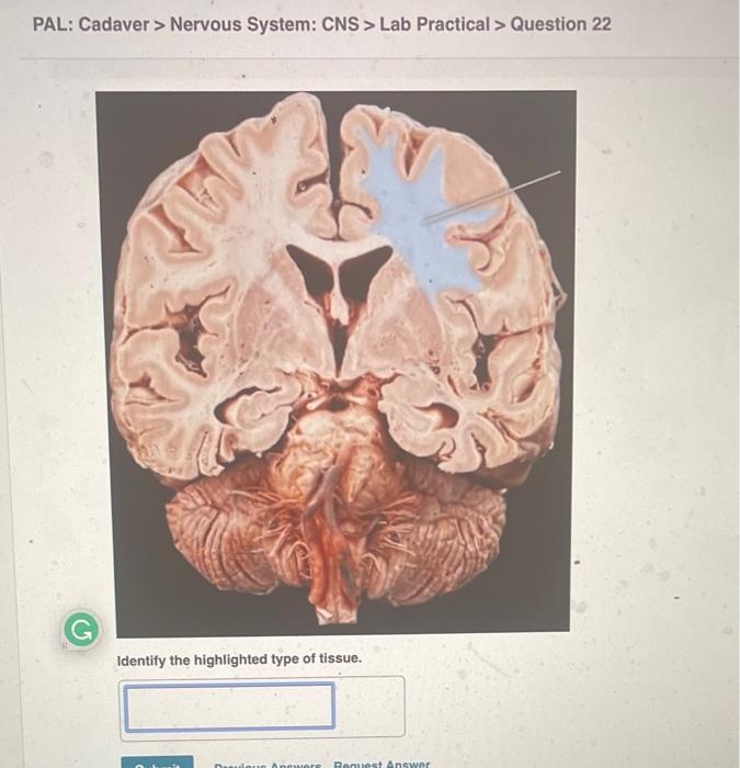 Pal Cadaver Nervous System Cns Lab Practical Question 11 Identify The Highlighted Structure 40 Pal Cadaver N 3