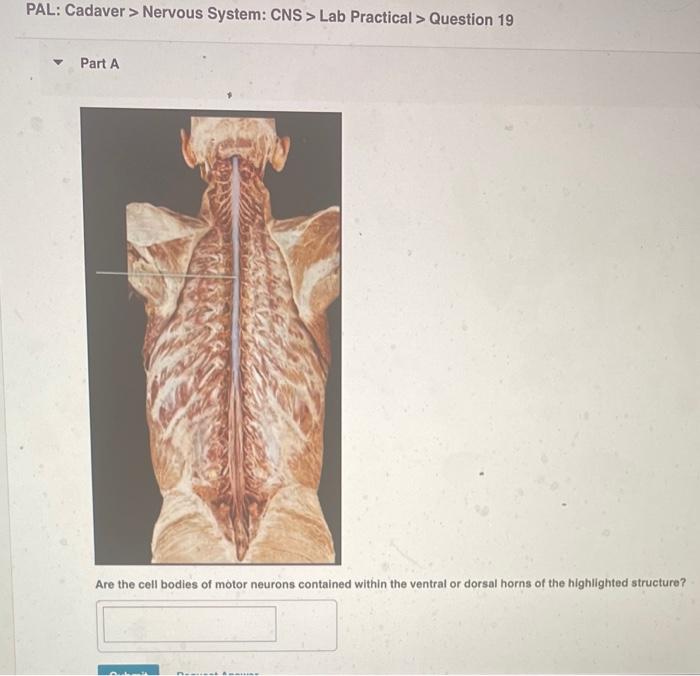Pal Cadaver Nervous System Cns Lab Practical Question 11 Identify The Highlighted Structure 40 Pal Cadaver N 4