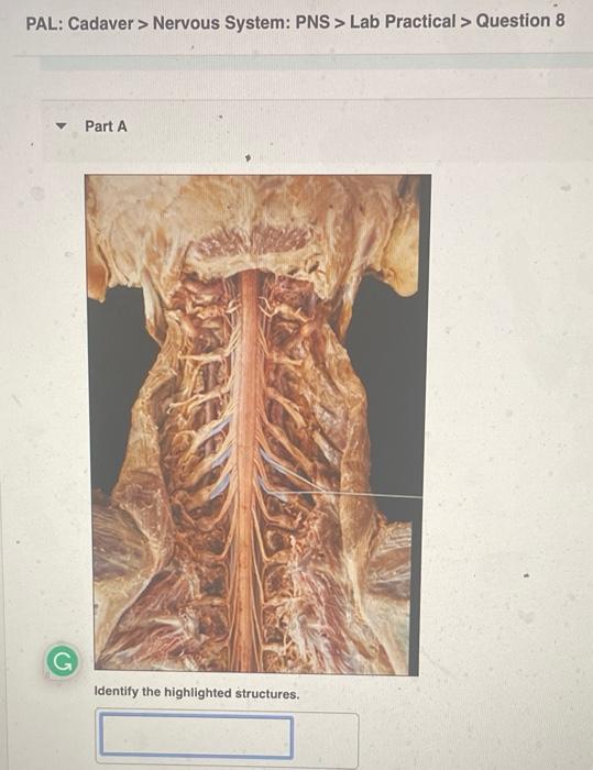 Pal Cadaver Nervous System Pns Lab Practical Question 12 Part A Identify The Highlighted Nerve Submit Request A 3