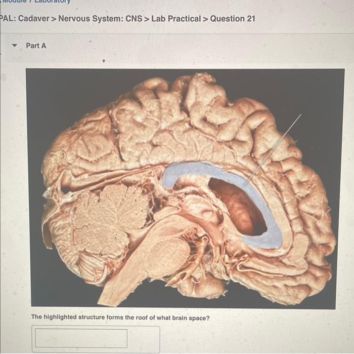 Pal Cadaver Nervous System Cns Lab Practical Question 21 Part A The Highlighted Structure Forms The Roof Of What 1