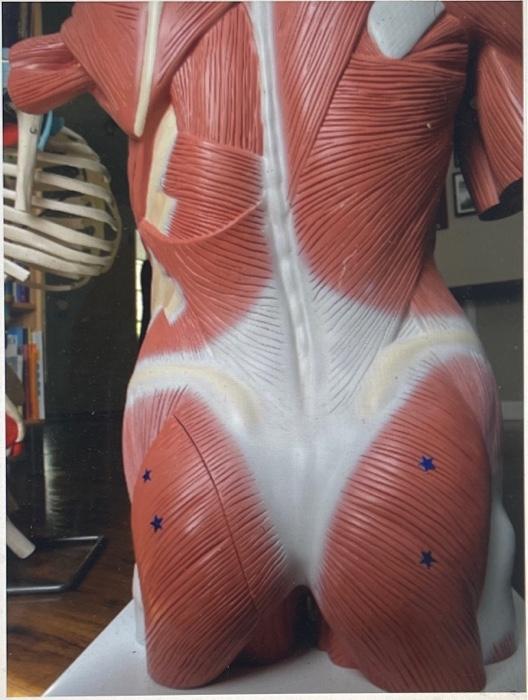 Identify The Bony Landmark Identify The Muscle That Proximally Attaches Here A 2 Words 1