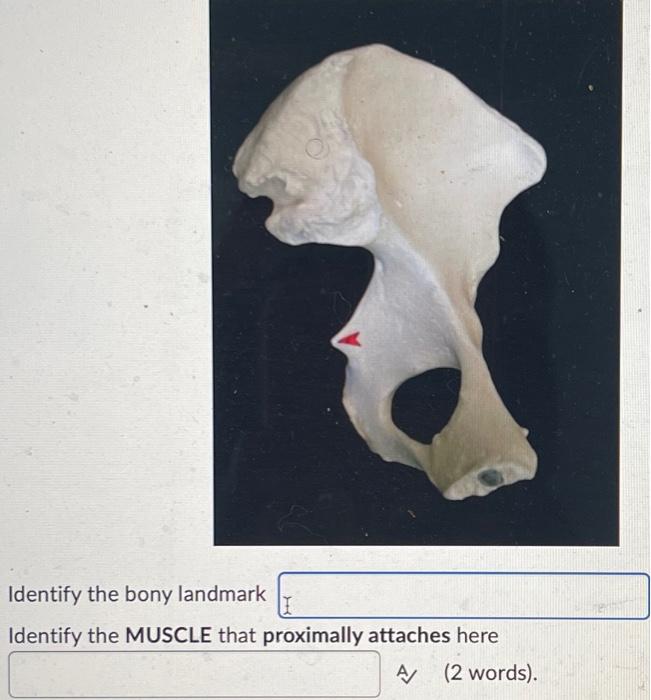 Identify The Bony Landmark Identify The Muscle That Proximally Attaches Here A 2 Words 2