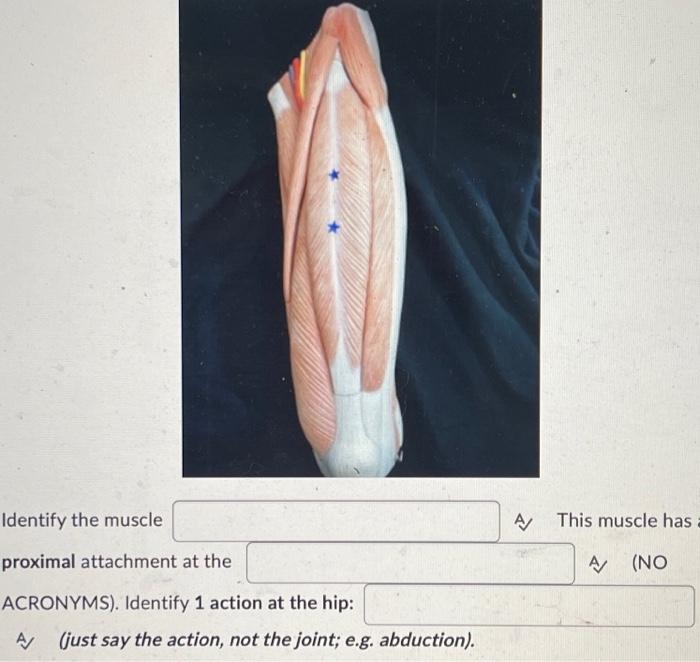 Identify The Muscle Proximal Attachment At The Acronyms Identify 1 Action At The Hip A Just Say The Action Not The 1
