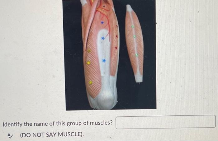 Identify The Bony Landmark Deepest Part Of The Bowl A 2 Words Identify The Name Of This Group Of Muscles A Do Not 2