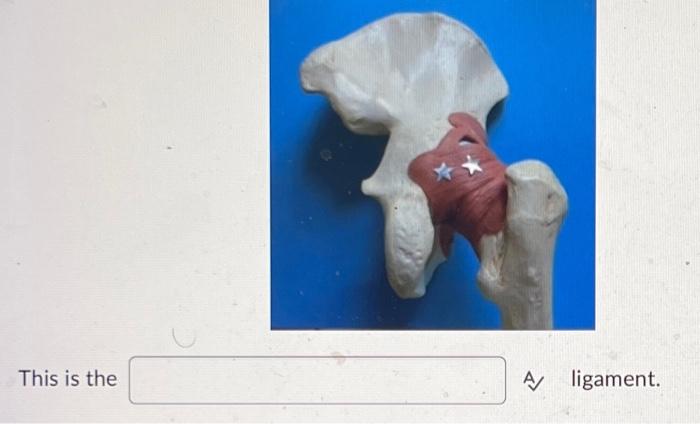 This Is The A Ligament This Is The A Ligament 1