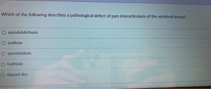 Which Of The Following Describes A Pathological Defect Of Pars Interarticularis Of The Vertebral Lamina O Spondylolisth 1