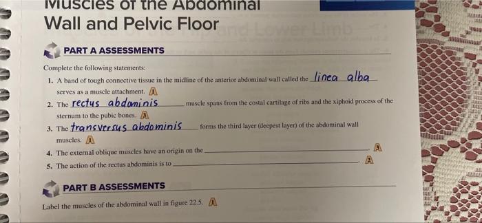 Ivius Es Of The Abdominal Wall And Pelvic Floor Part A Assessments Complete The Following Statements 1 A Band Of Tough 1